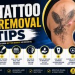 tattoo removal tips